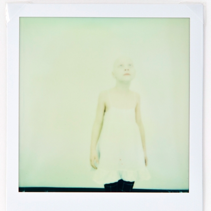Anoushka IV. From the series "OMG, She is Bald!" by Annika Haas